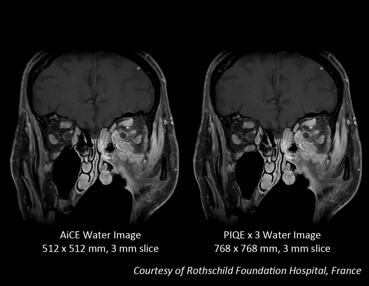 Key Clinical Imaging Tips for V9.0 PIQE Validation Sites in Europe