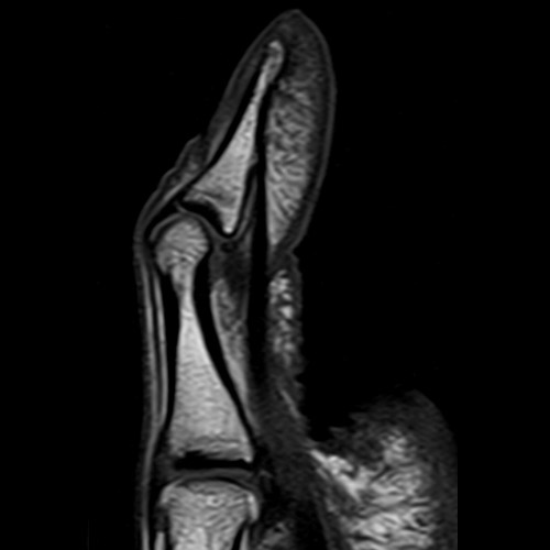Hand IRM
