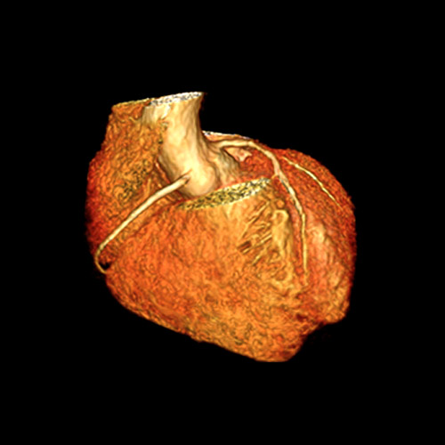 Heart IRM 4