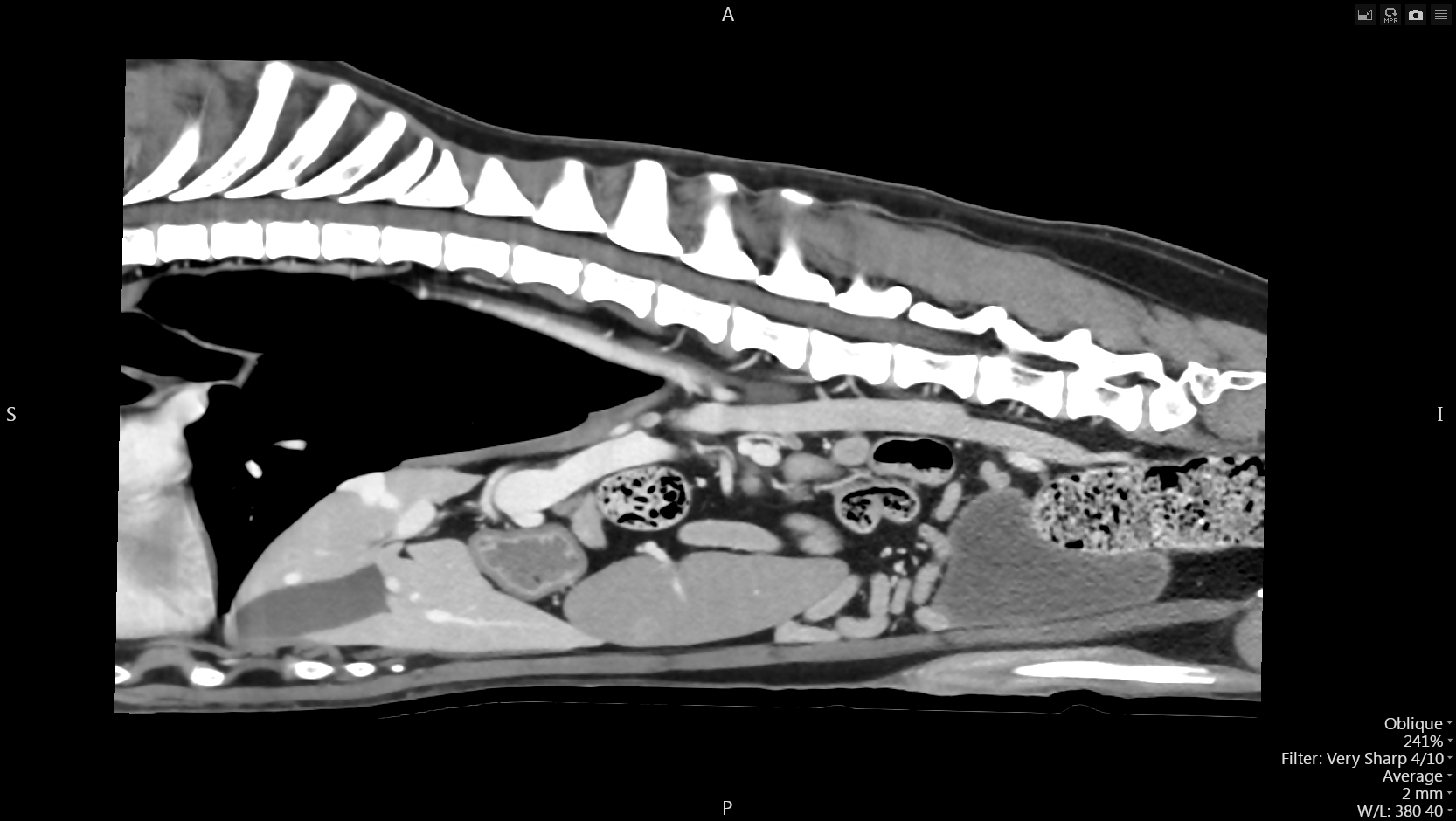 Body Thorax - TDM