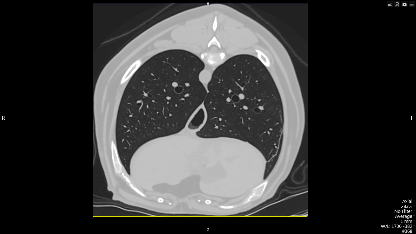 Body Thorax - TDM