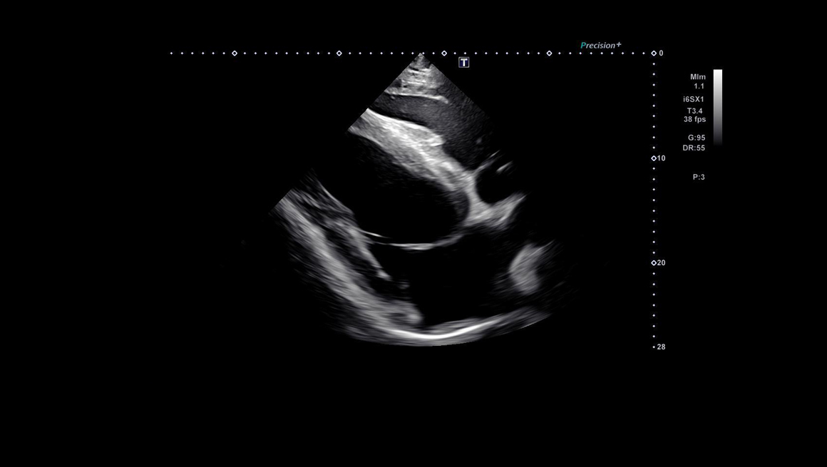 Body Cardiovascular - Ultrasound