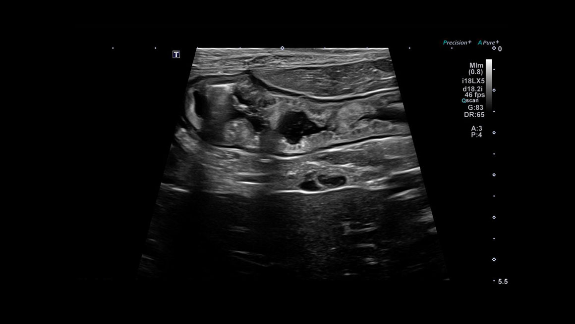 Body General Imaging - Ultrasound