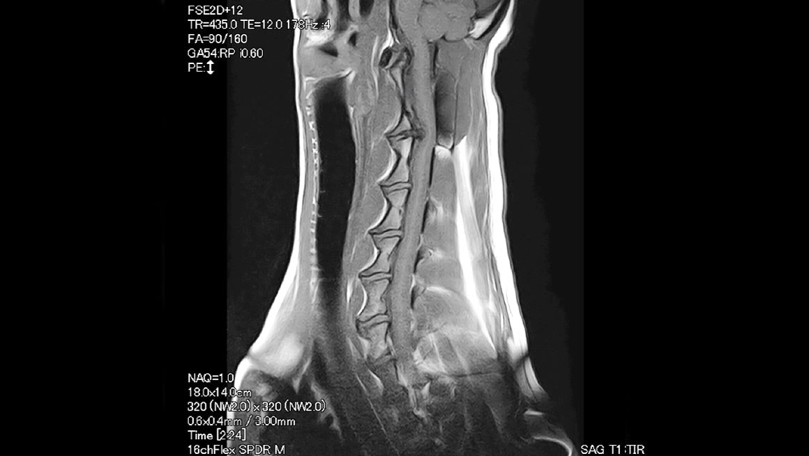Body Colonne cervicale du chien - IRM