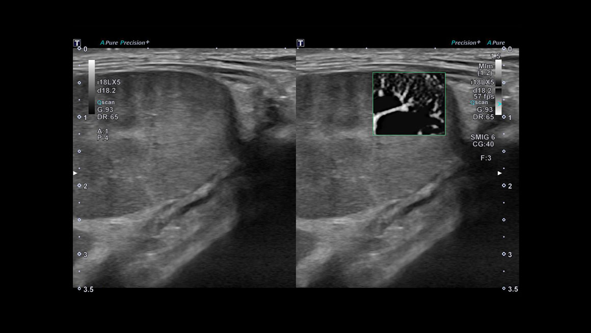 Body Cardiovascular - Ultrasound