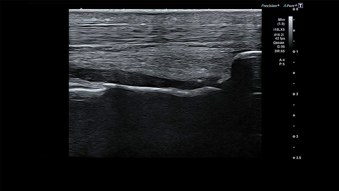 Body General Imaging - Ultrasound