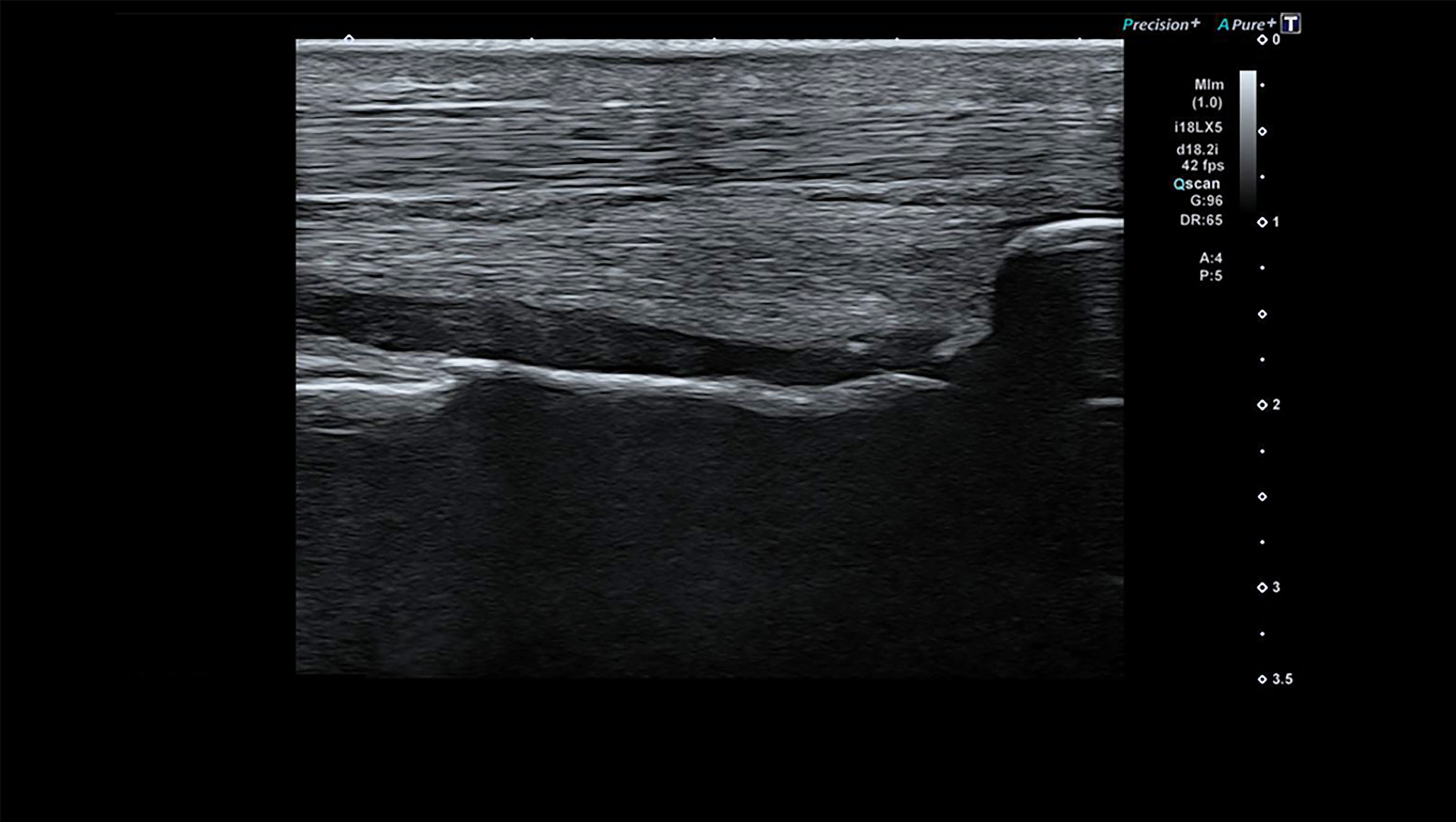 Body General Imaging - Ultrasound