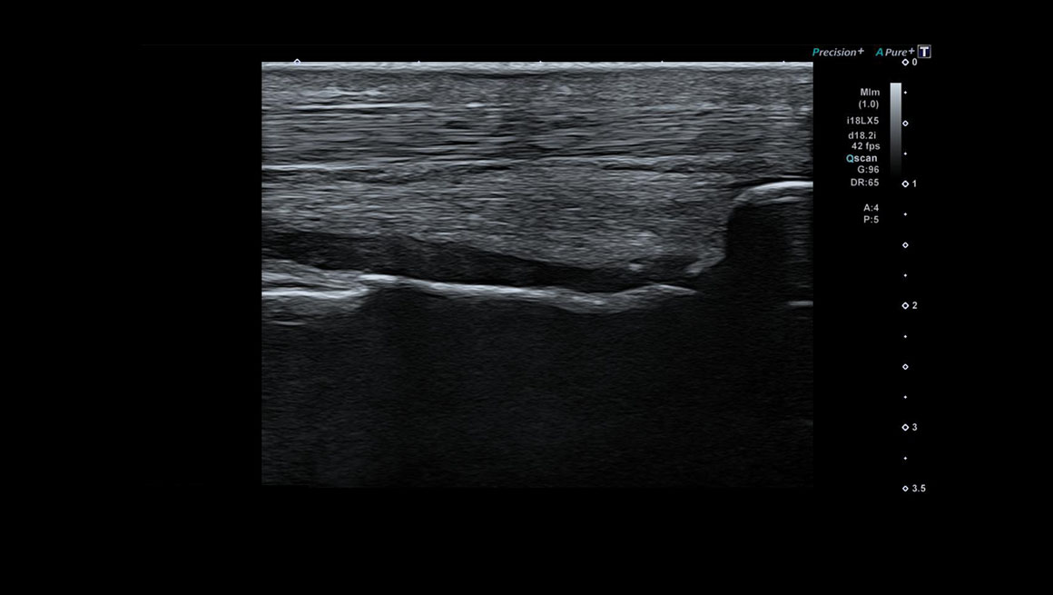 Body General Imaging - Ultrasound
