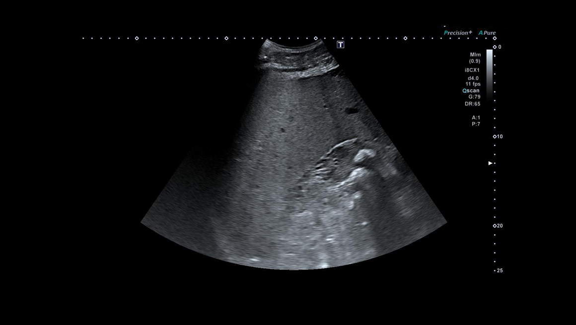 Body General Imaging - Ultrasound
