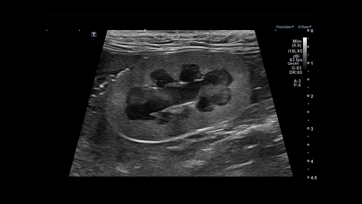 Body General Imaging - Ultrasound