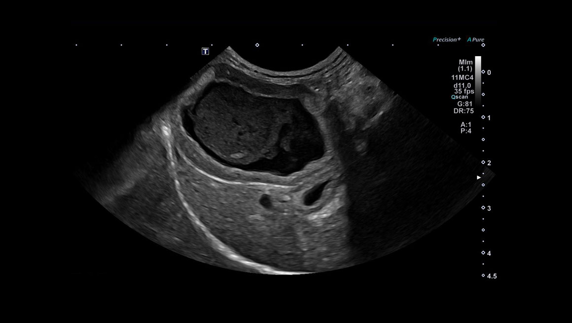 Body General Imaging - Ultrasound