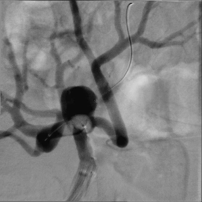 Interventional Radiology Imagerie Hi-Def*