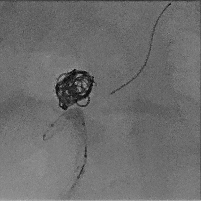 Interventional Radiology Imagerie Hi-Def*