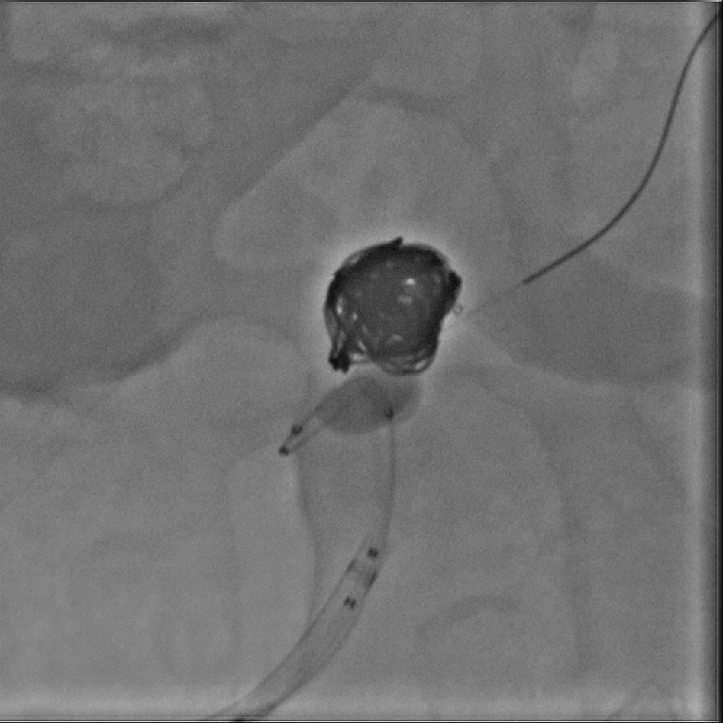 Interventional Radiology Imagerie Hi-Def*