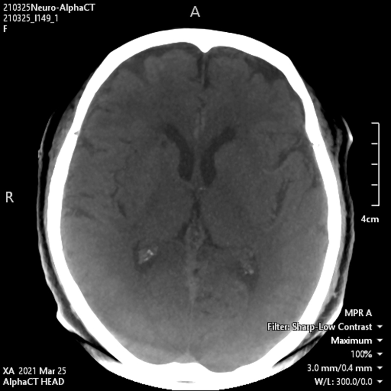 Neurology Images en 3D