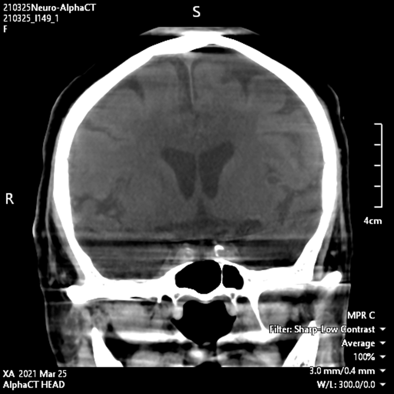 Neurology Images en 3D