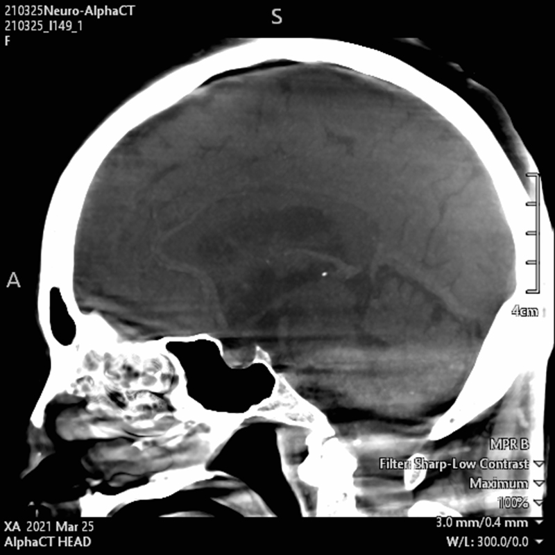 Neurology Images en 3D