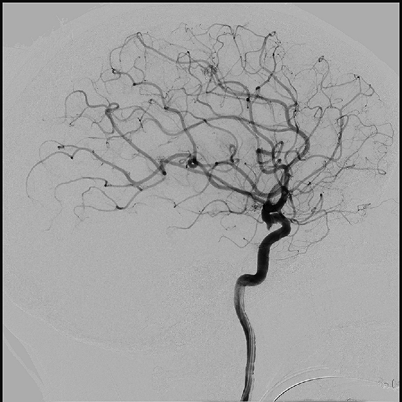 Neurology Images en 2D