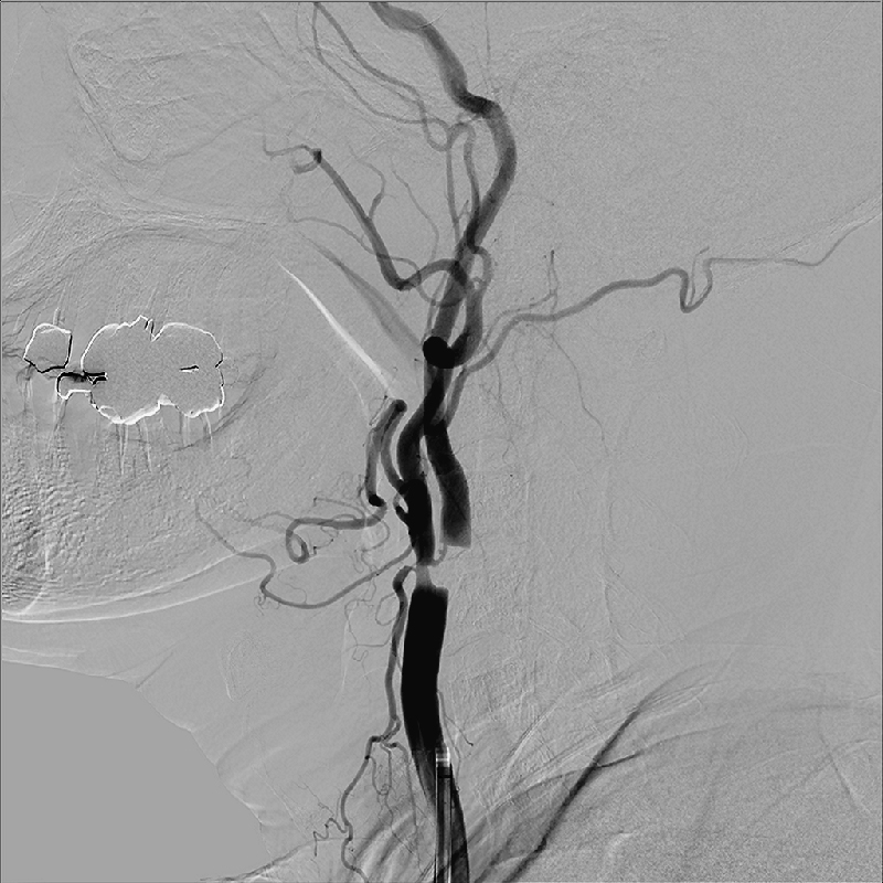Neurology Images en 2D