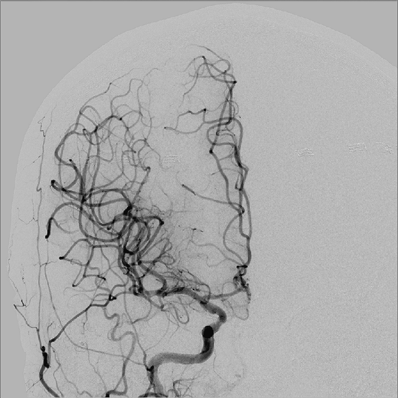 Neurology Images en 2D