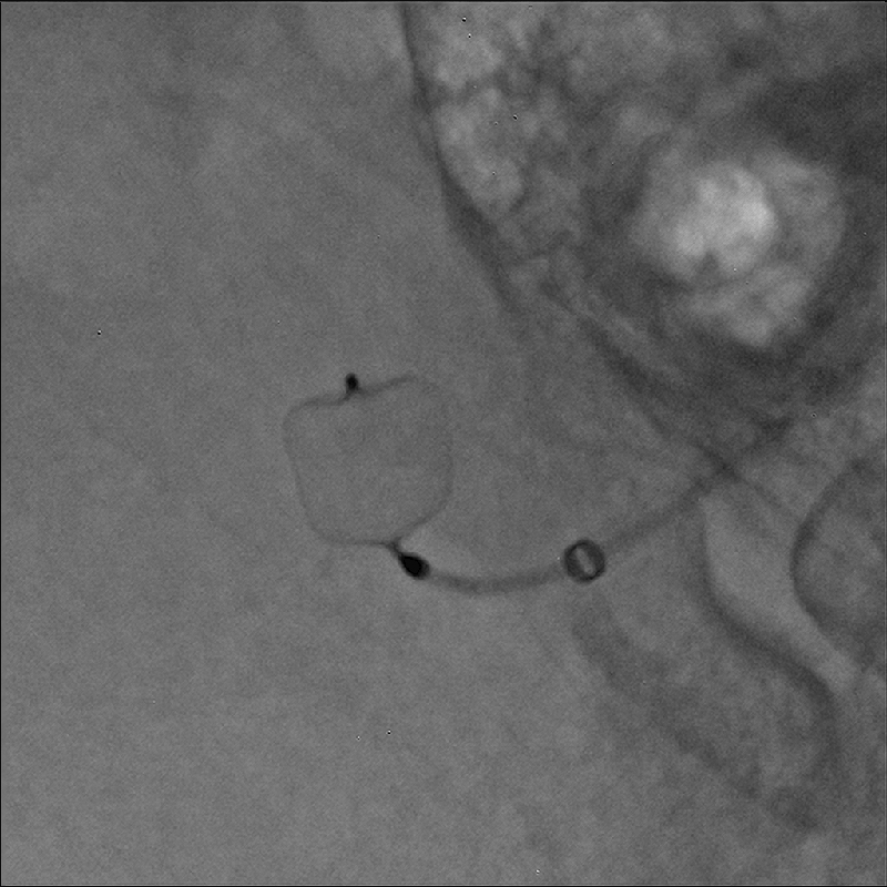Neurology Imagerie Hi-Def *