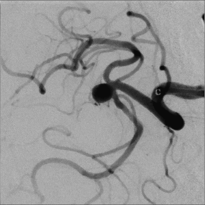 Neurology Imagerie Hi-Def *