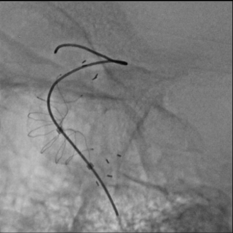Neurology Imagerie Hi-Def *
