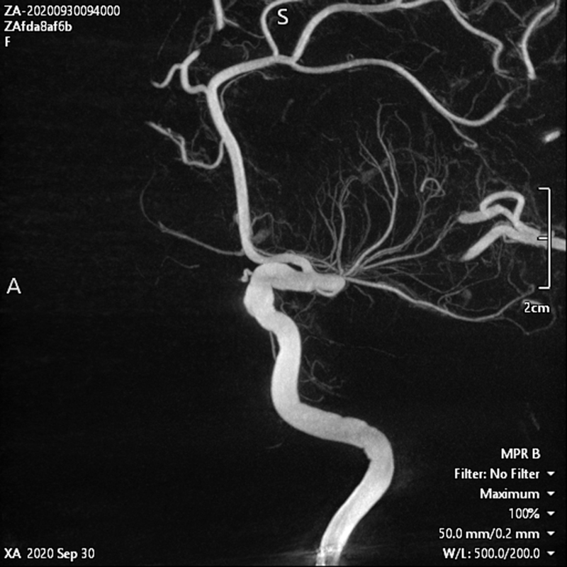 Neurology Images en 3D