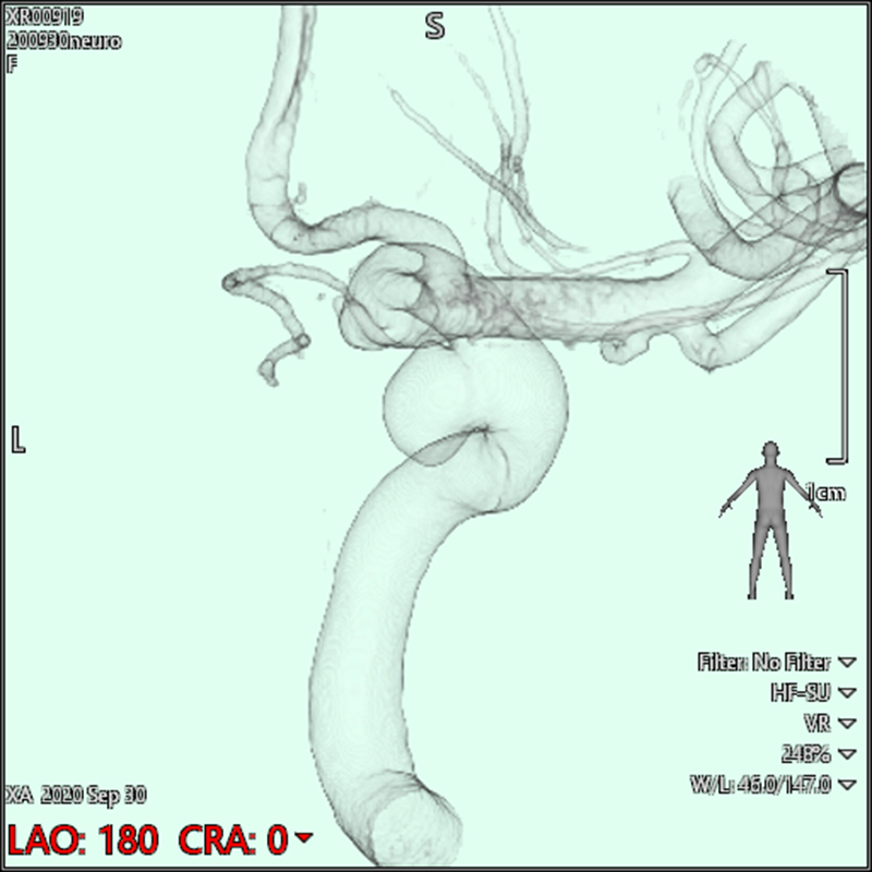 Neurology Images en 3D