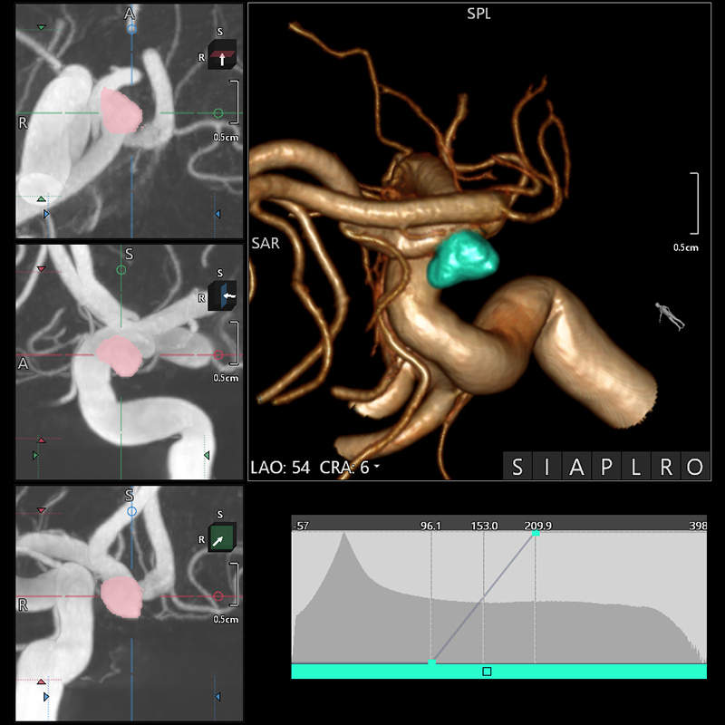 Neurology Images en 3D