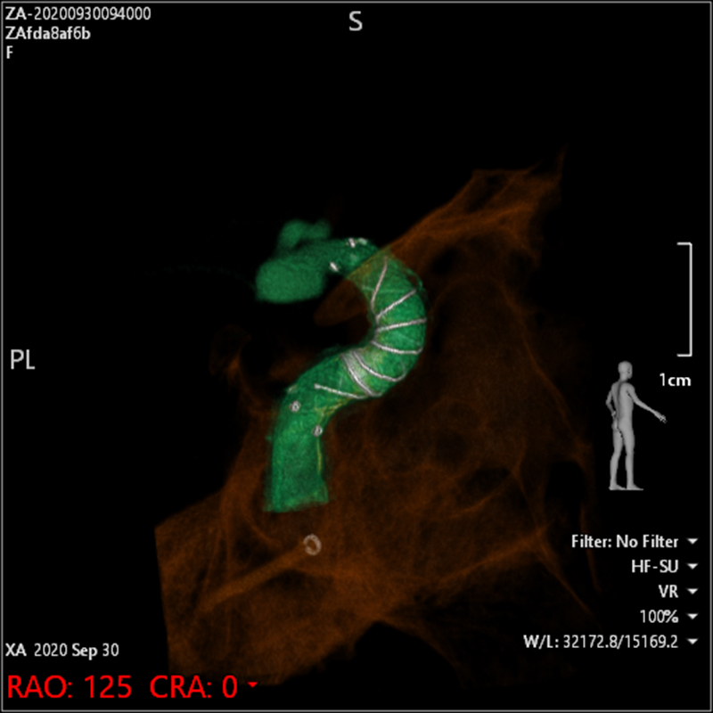 Neurology Images en 3D