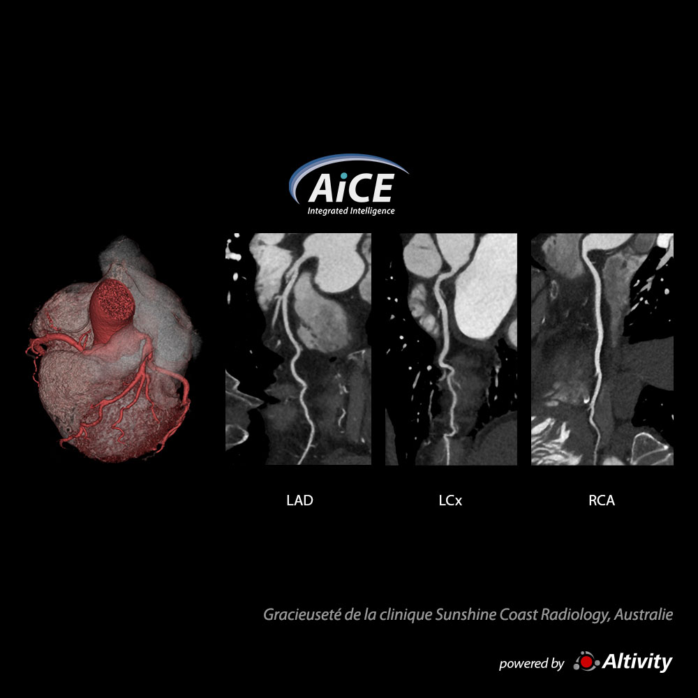 Cardiac Cardiaque 1,8 mSv