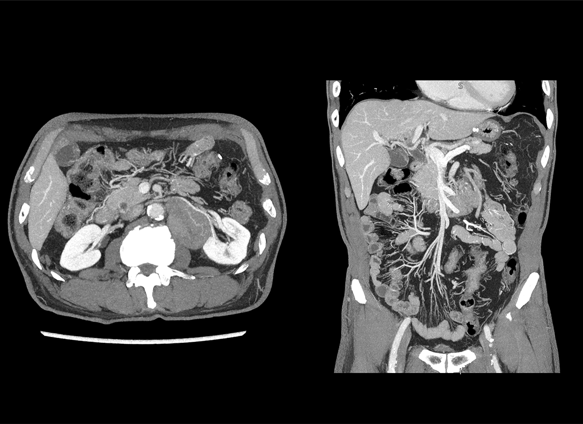 Body Oncologie