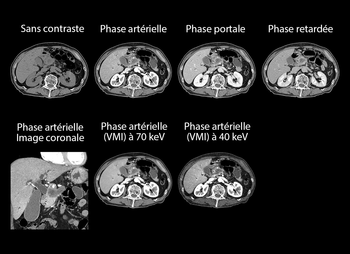 Body Imagerie multiphase