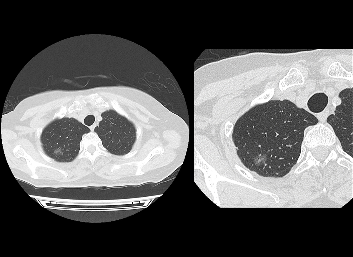 Chest Thorax 4