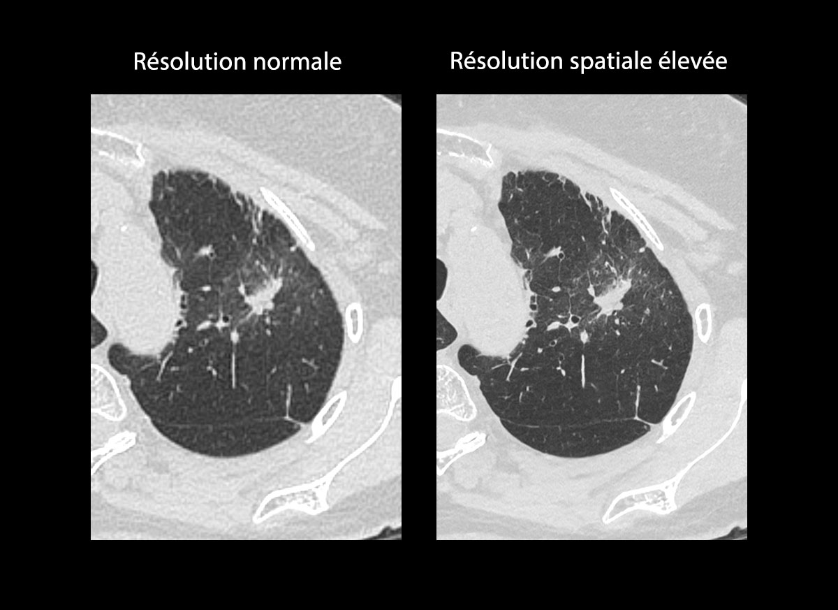 Chest Thorax 3