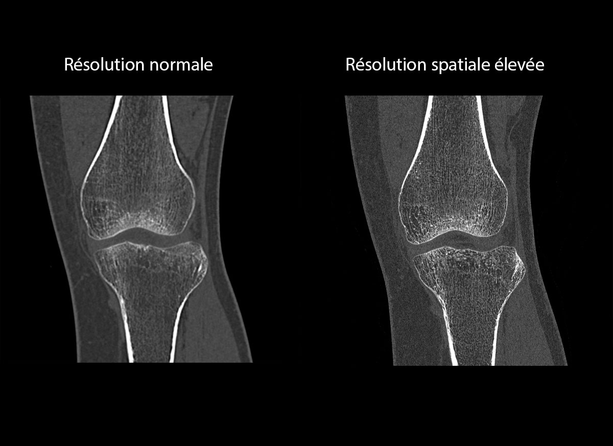 Knee Genou 1