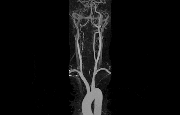 Angiography Cou