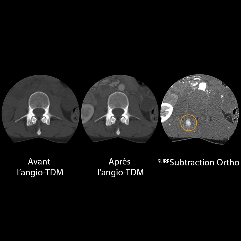 Iodine Mapping Ortho