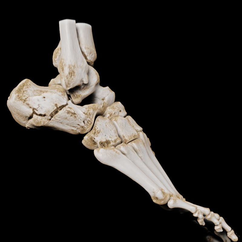 Lowerbody Pied