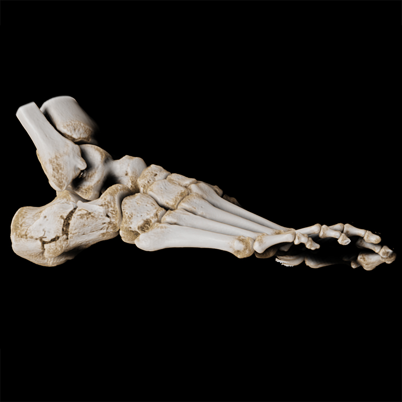 Lowerbody Pied