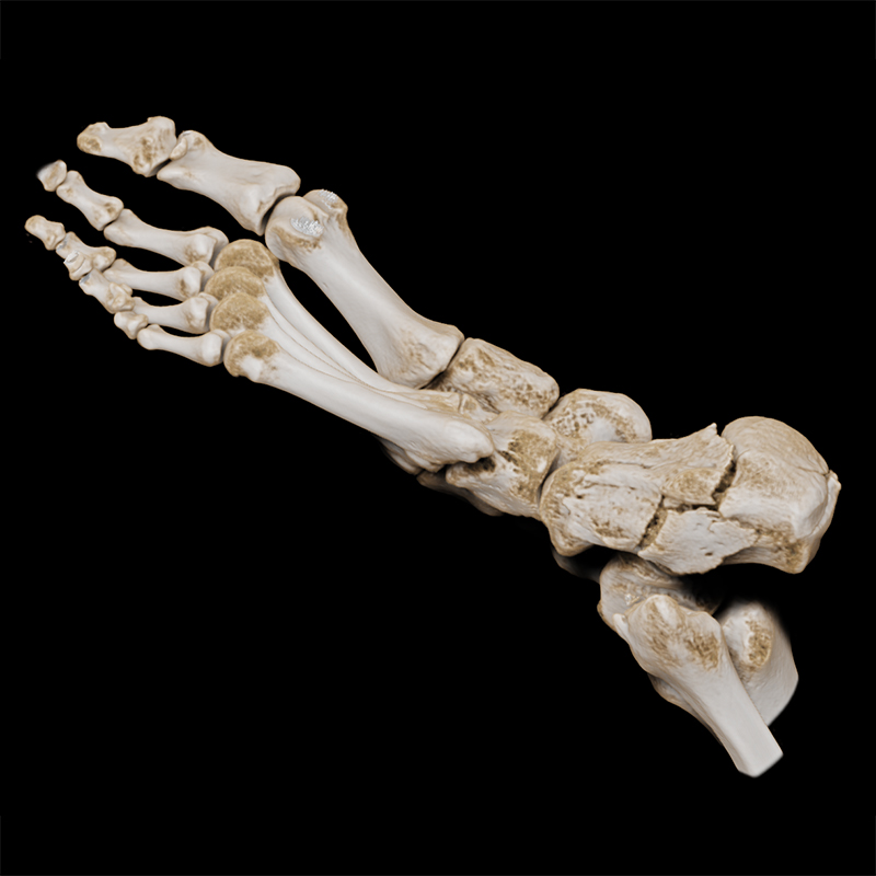 Lowerbody Pied
