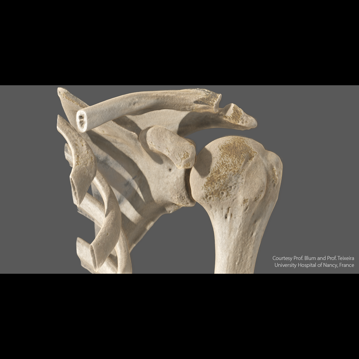 Upperbody Épaule