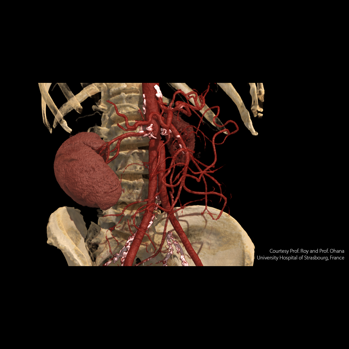 Upperbody Abdomen