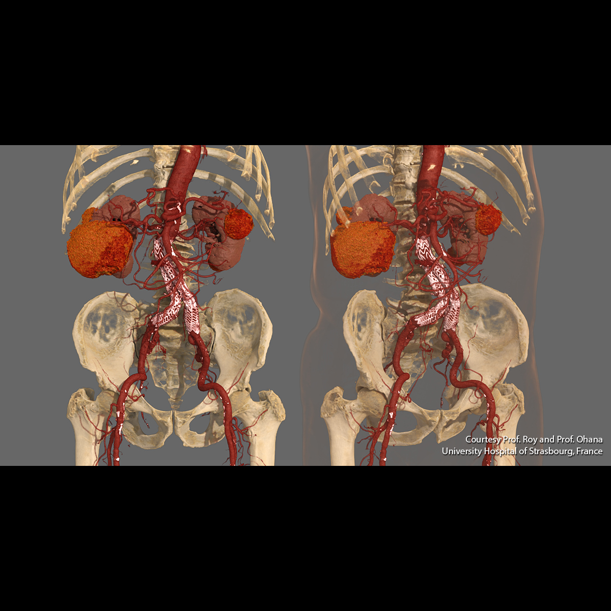 Upperbody Abdomen