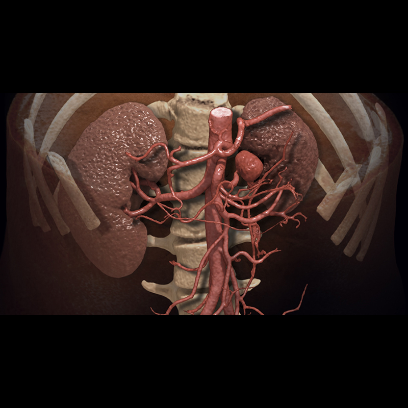 Upperbody Abdomen