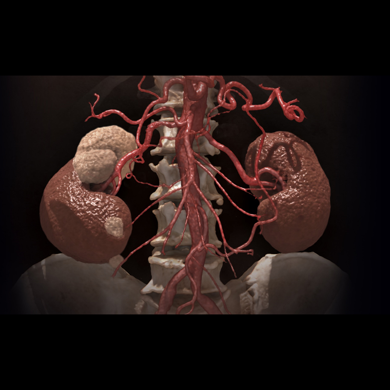 Upperbody Abdomen