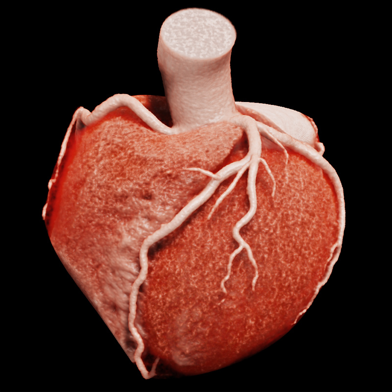 Upperbody Cardiaque