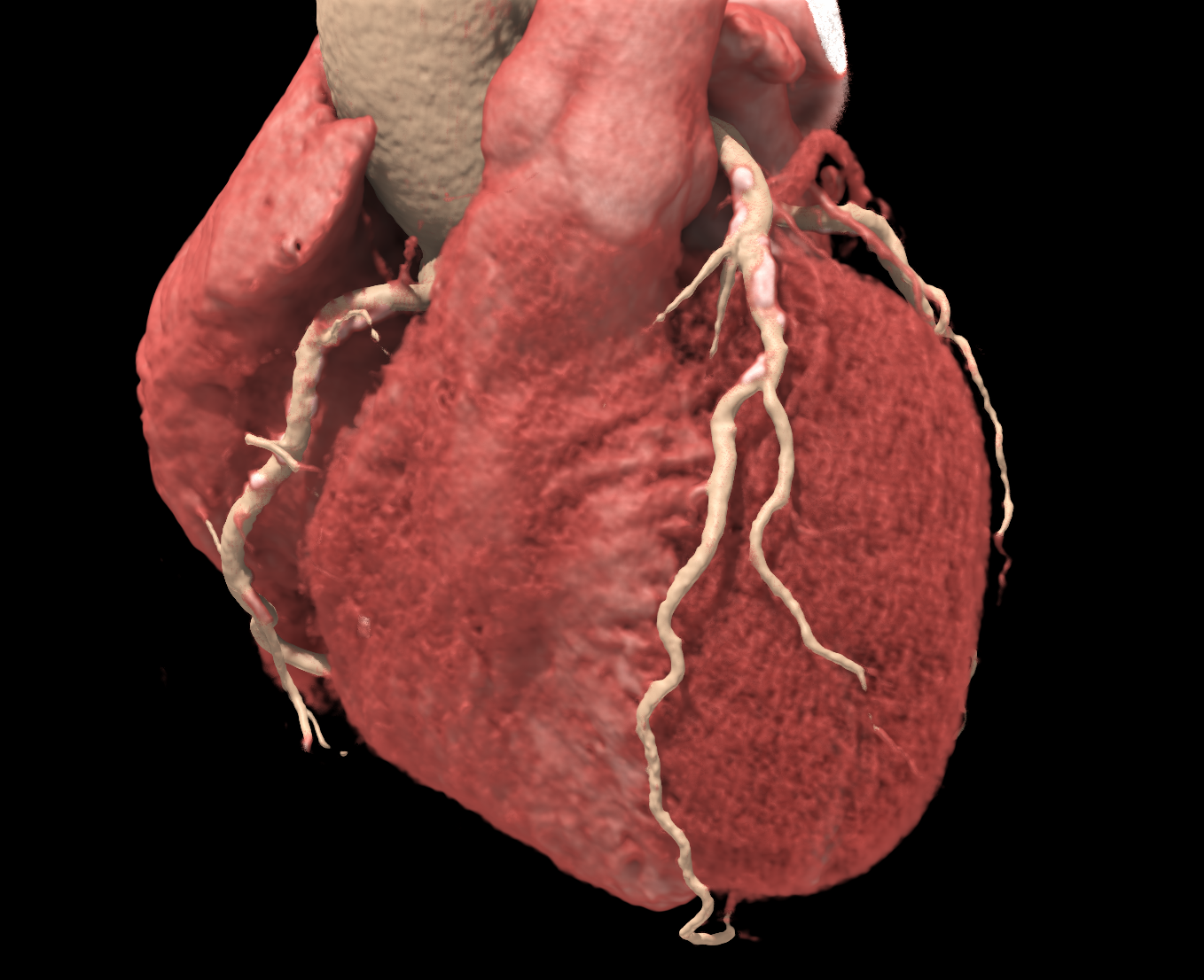 Upperbody Cardiaque