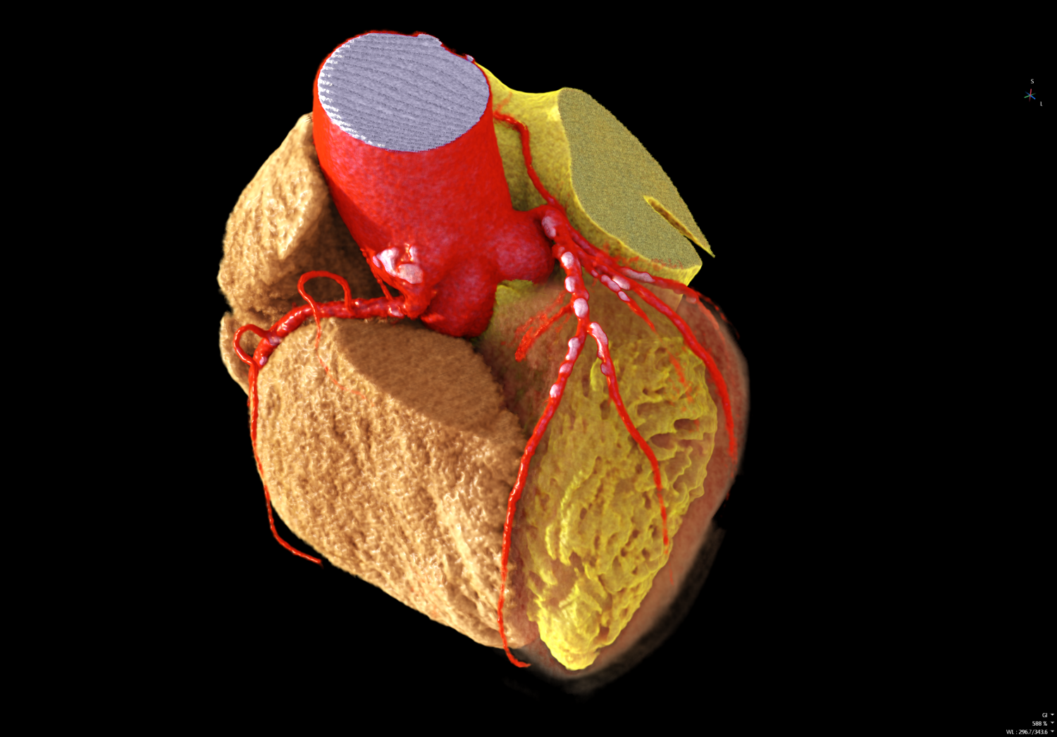 Upperbody Cardiaque